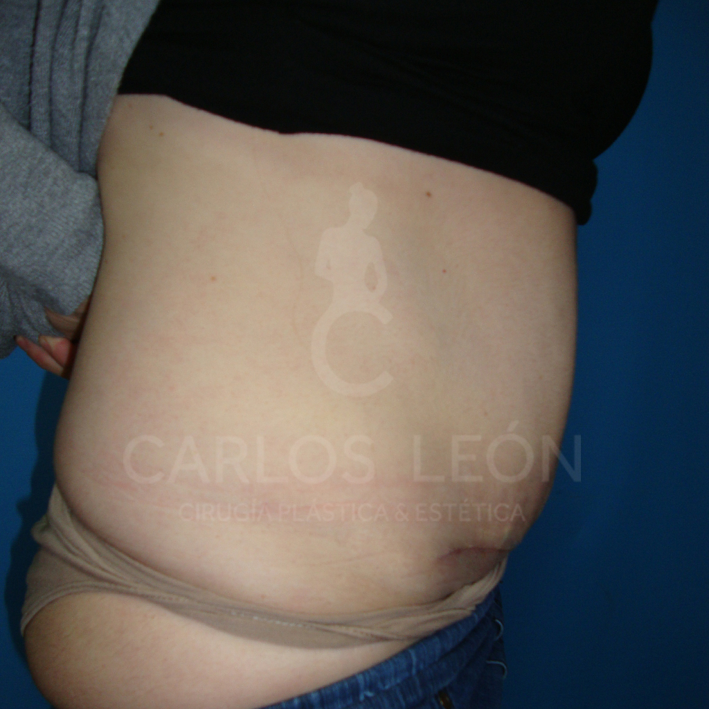 Perfil dcho post logo