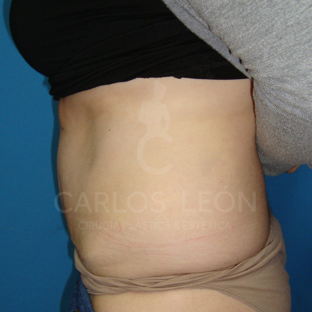 Perfil izq post logo